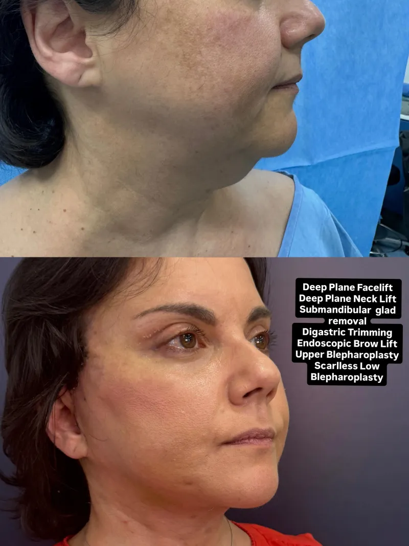 Before and after — Dr. Vasileios Kretsis
