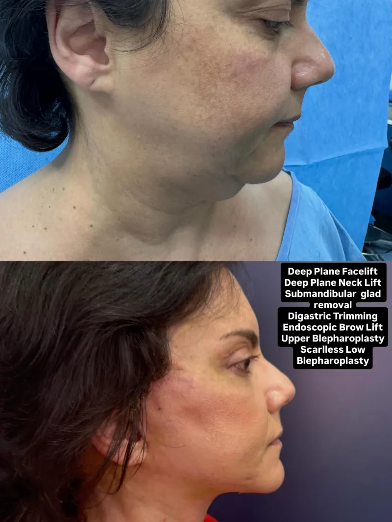 Before and after — Dr. Vasileios Kretsis