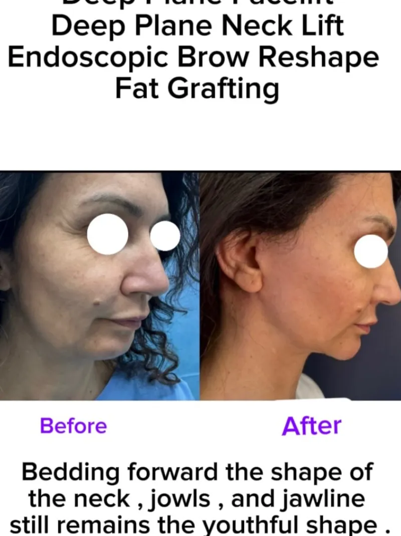 Before and after — Dr. Vasileios Kretsis