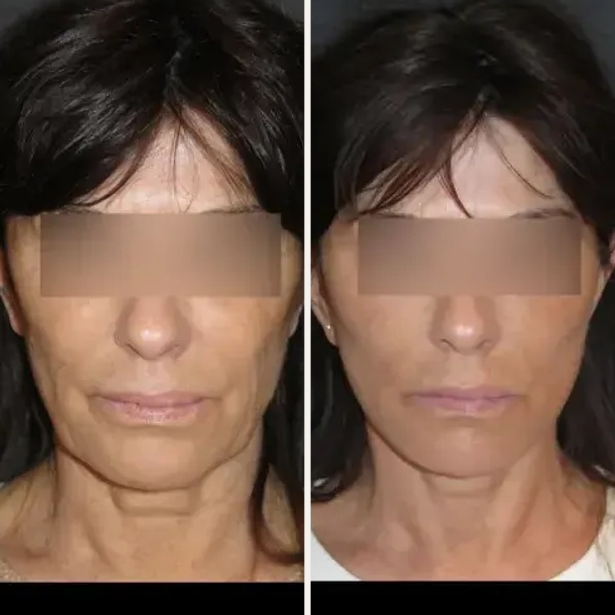 Before and after: Dr. Vincent Nguyen