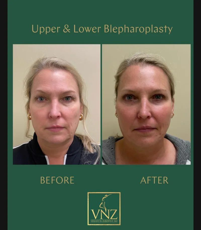 Before and after: Dr. Vincent Zubowicz