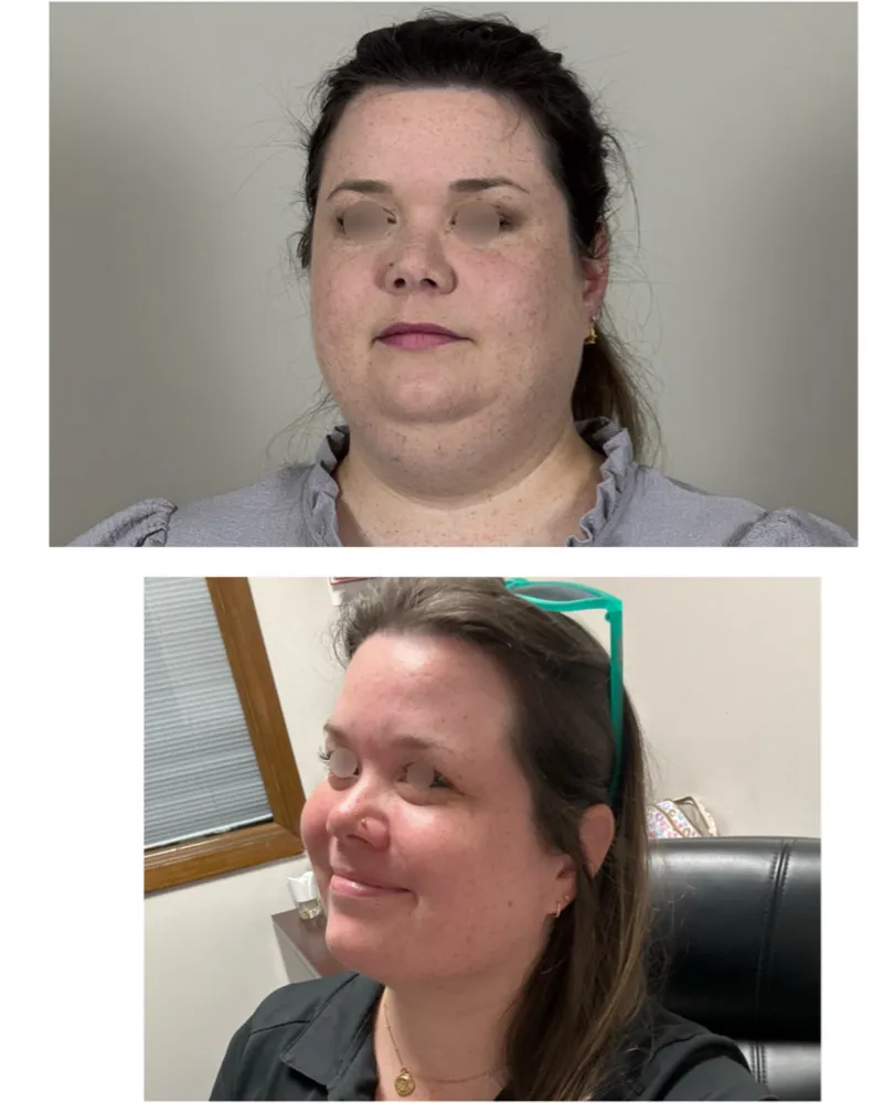 Before and after: Dr. Vipul Gargya