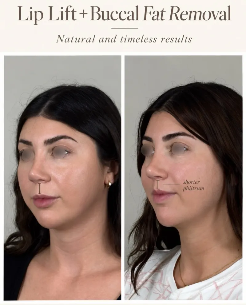 Before and after: Dr. Vipul Gargya