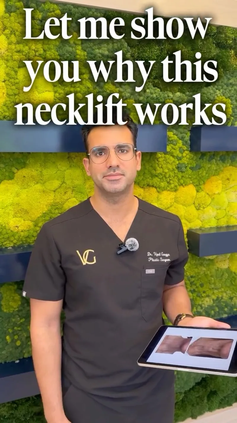 Before and after: Dr. Vipul Gargya