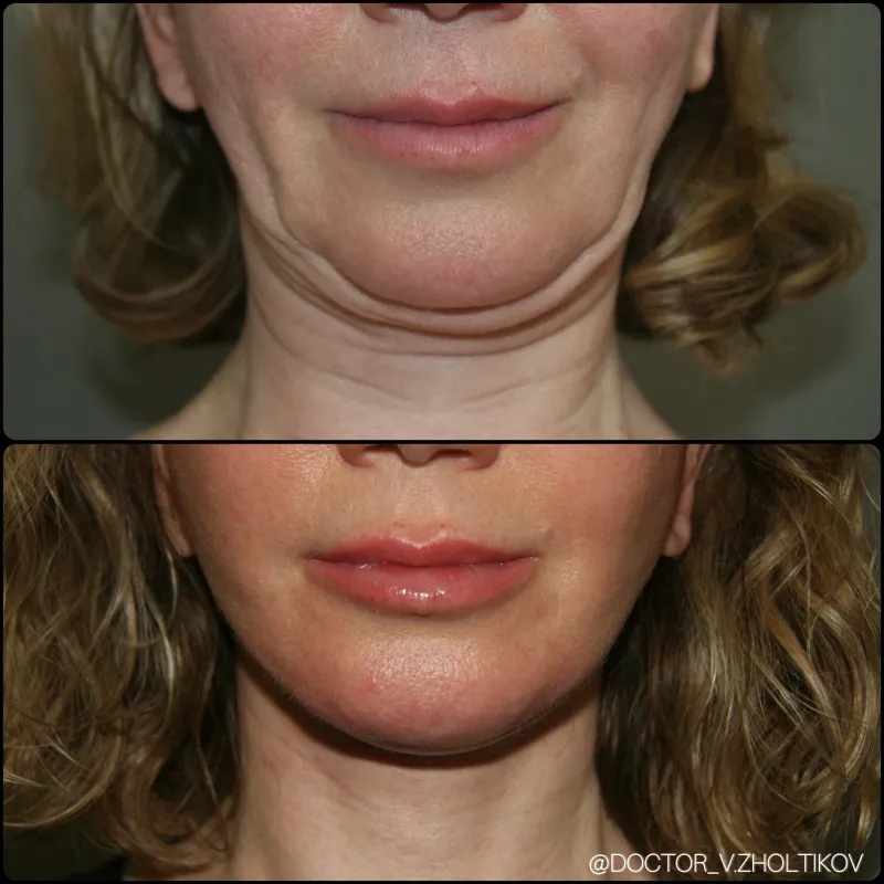 Before and after: Dr. Виталий Жолтиков