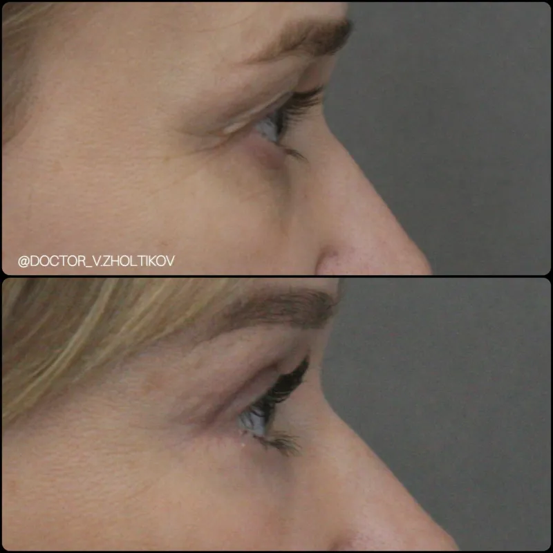 Before and after: Dr. Виталий Жолтиков