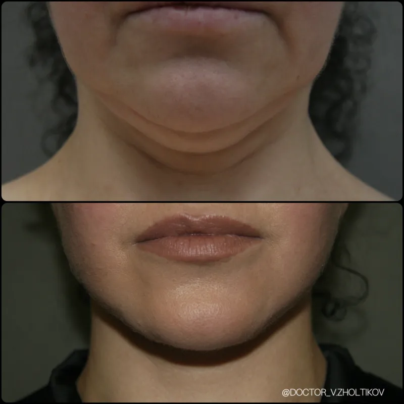 Before and after: Dr. Виталий Жолтиков