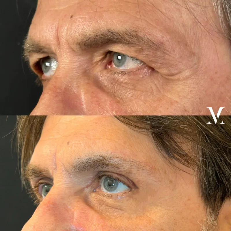 Before and after — Dr. Vittoria Murone