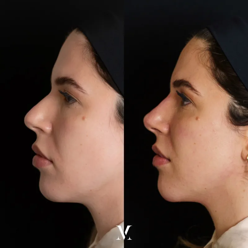 Before and after — Dr. Vittoria Murone