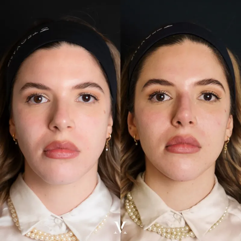 Before and after — Dr. Vittoria Murone