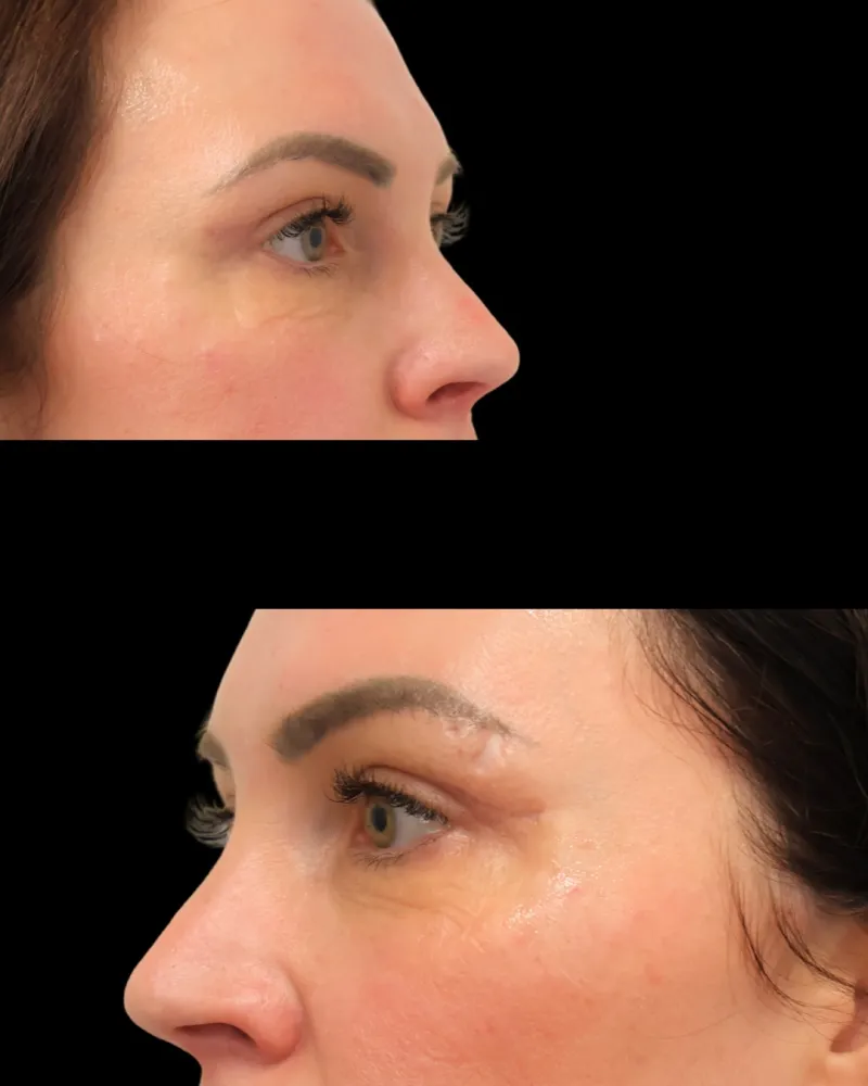 Before and after — Dr. Wasim Sakas