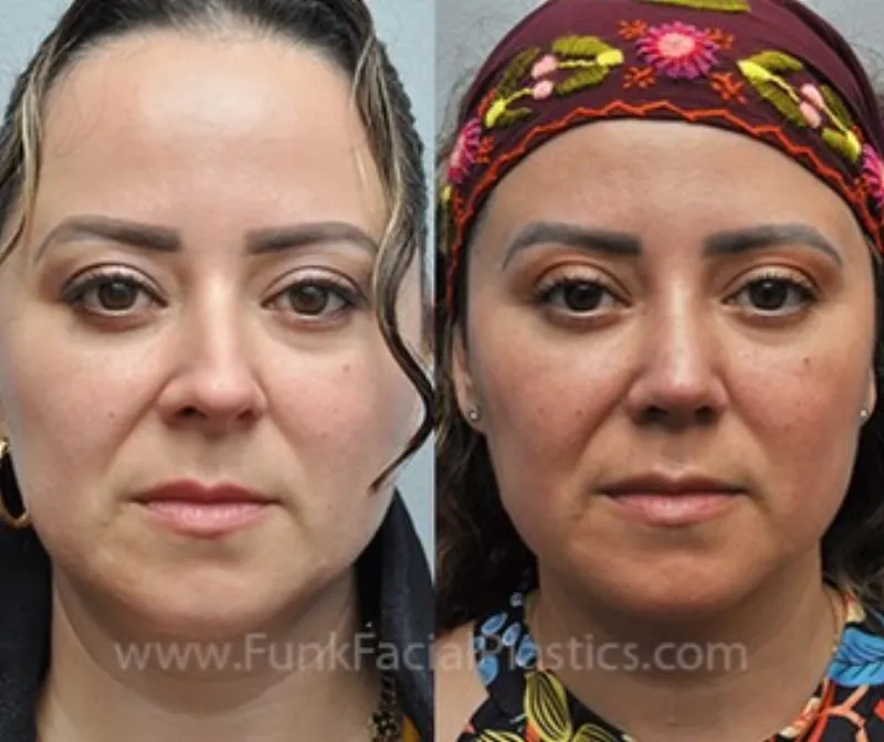 Before and after: Dr. Wolfgang Funk