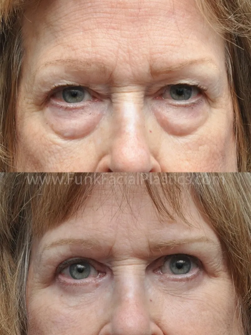Before and after: Dr. Wolfgang Funk
