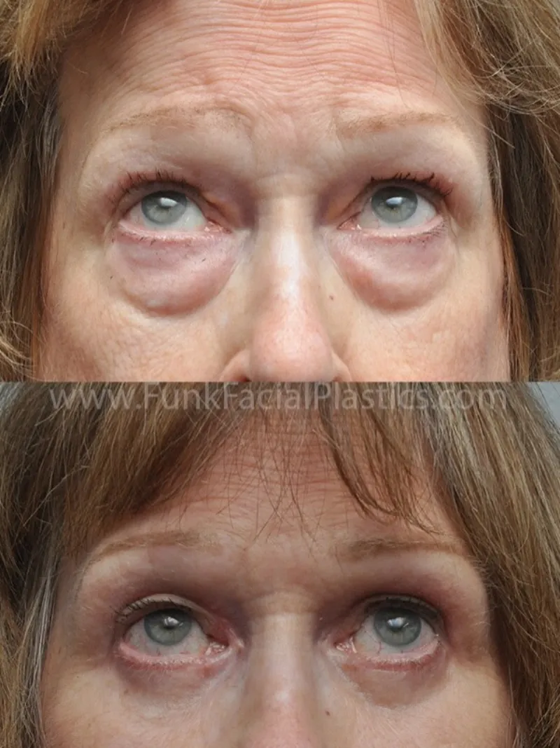 Before and after: Dr. Wolfgang Funk