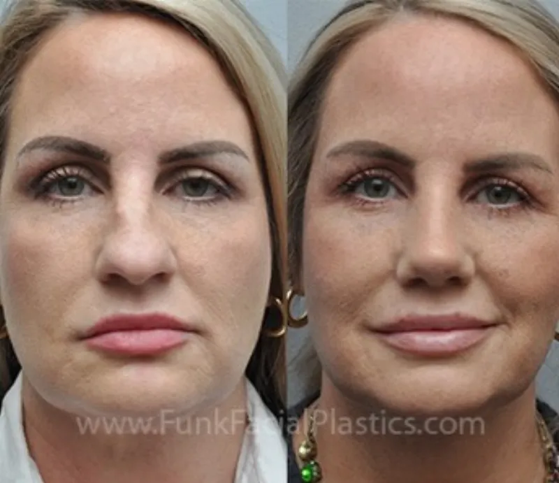 Before and after: Dr. Wolfgang Funk
