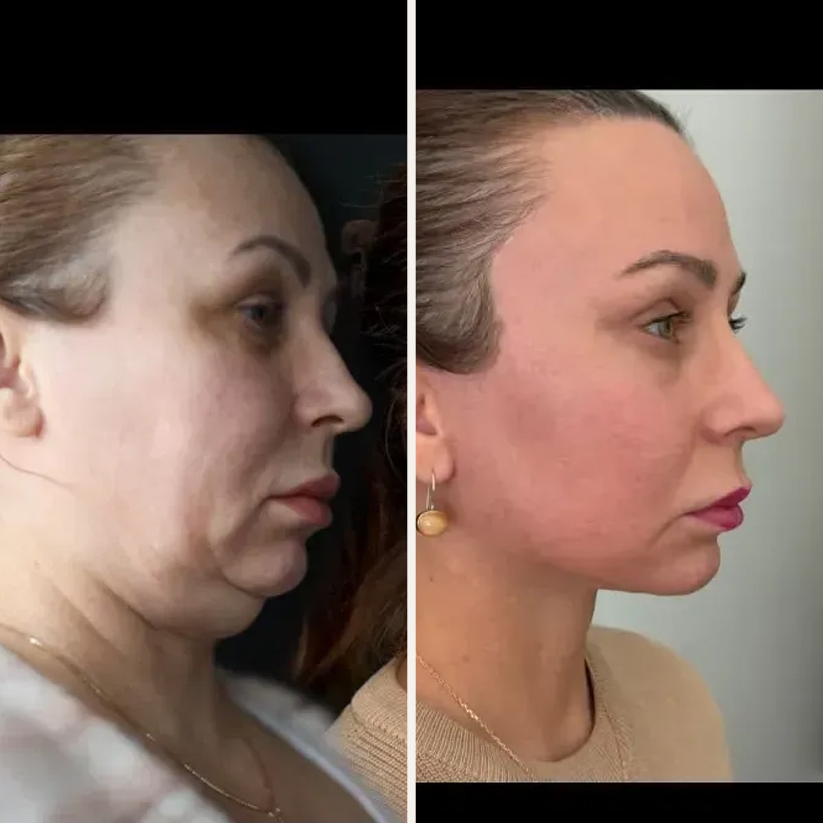Before and after: Dr. Wouter van der Pot