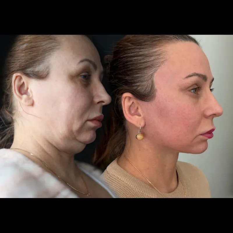 Before and after — Dr. Wouter van der Pot