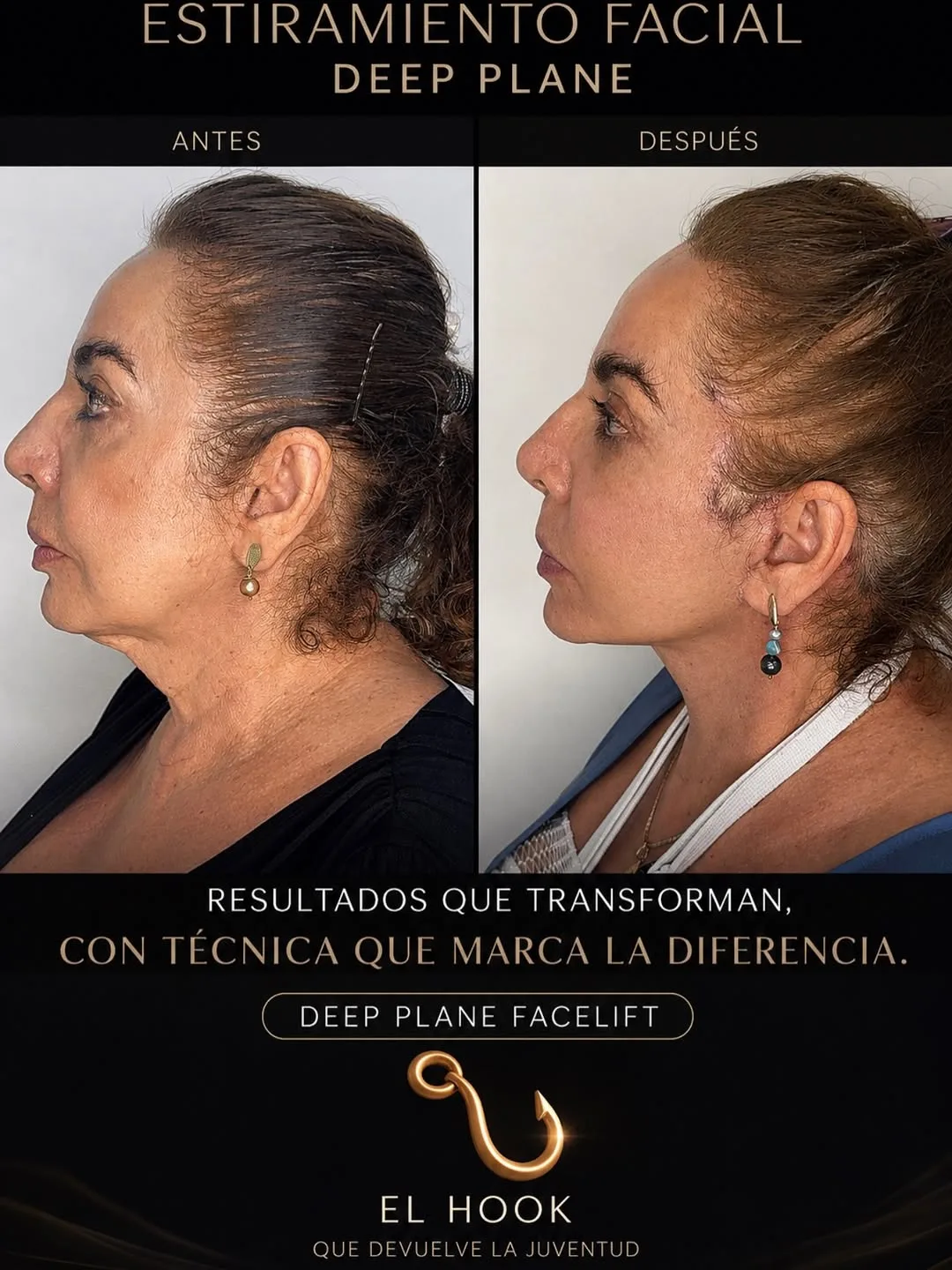 Before and after — Dr. Xavier Sánchez García