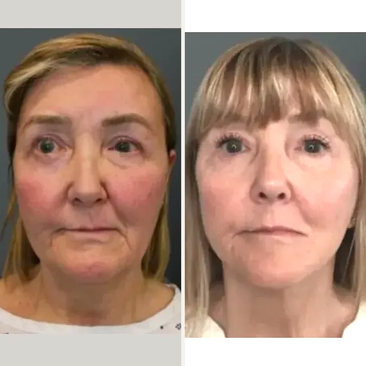 Before and after: Dr. Yannis Alexandrides