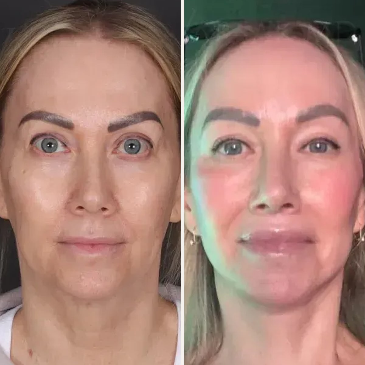 Before and after: Dr. Yasin Varsak