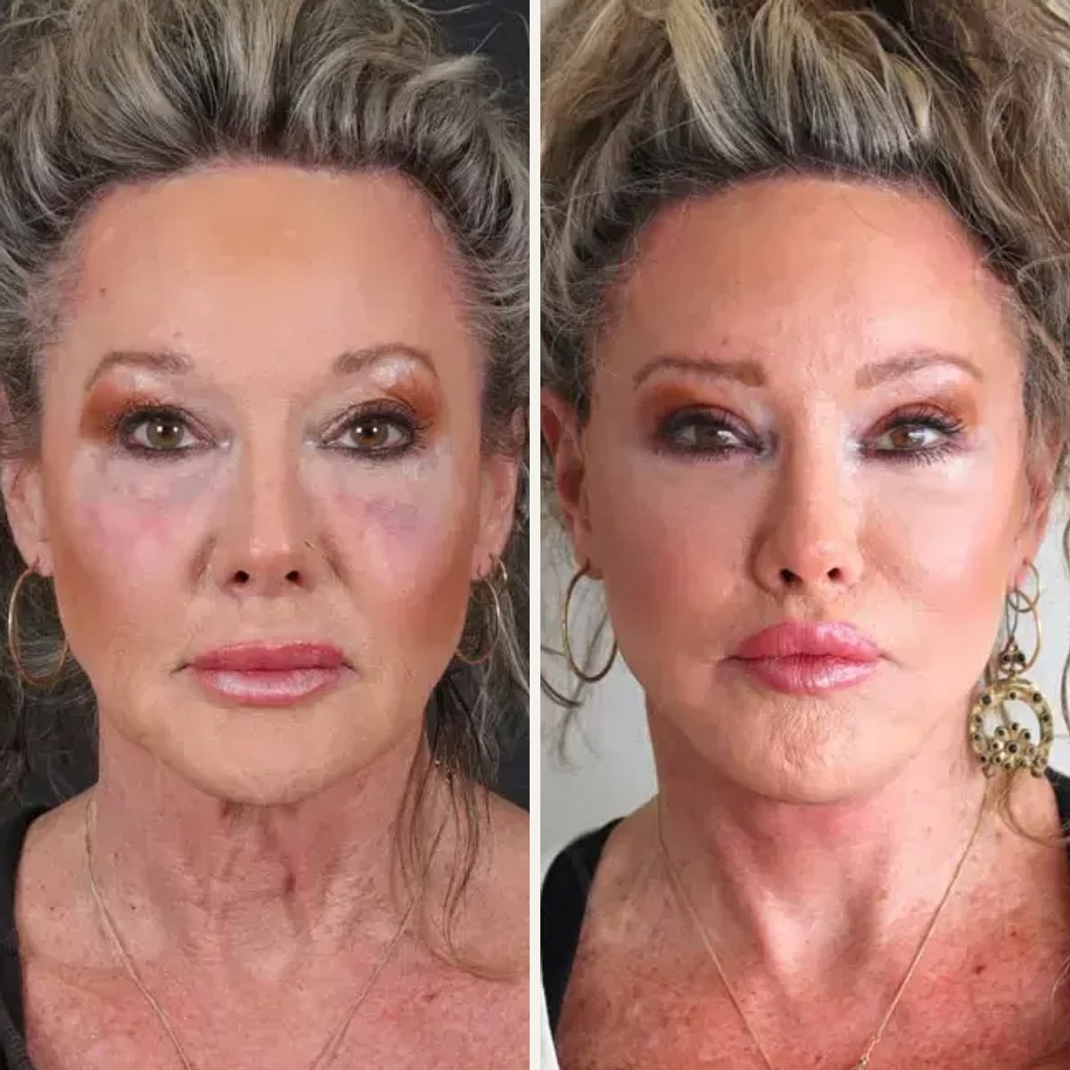 Before and after: Dr. Yasin Varsak