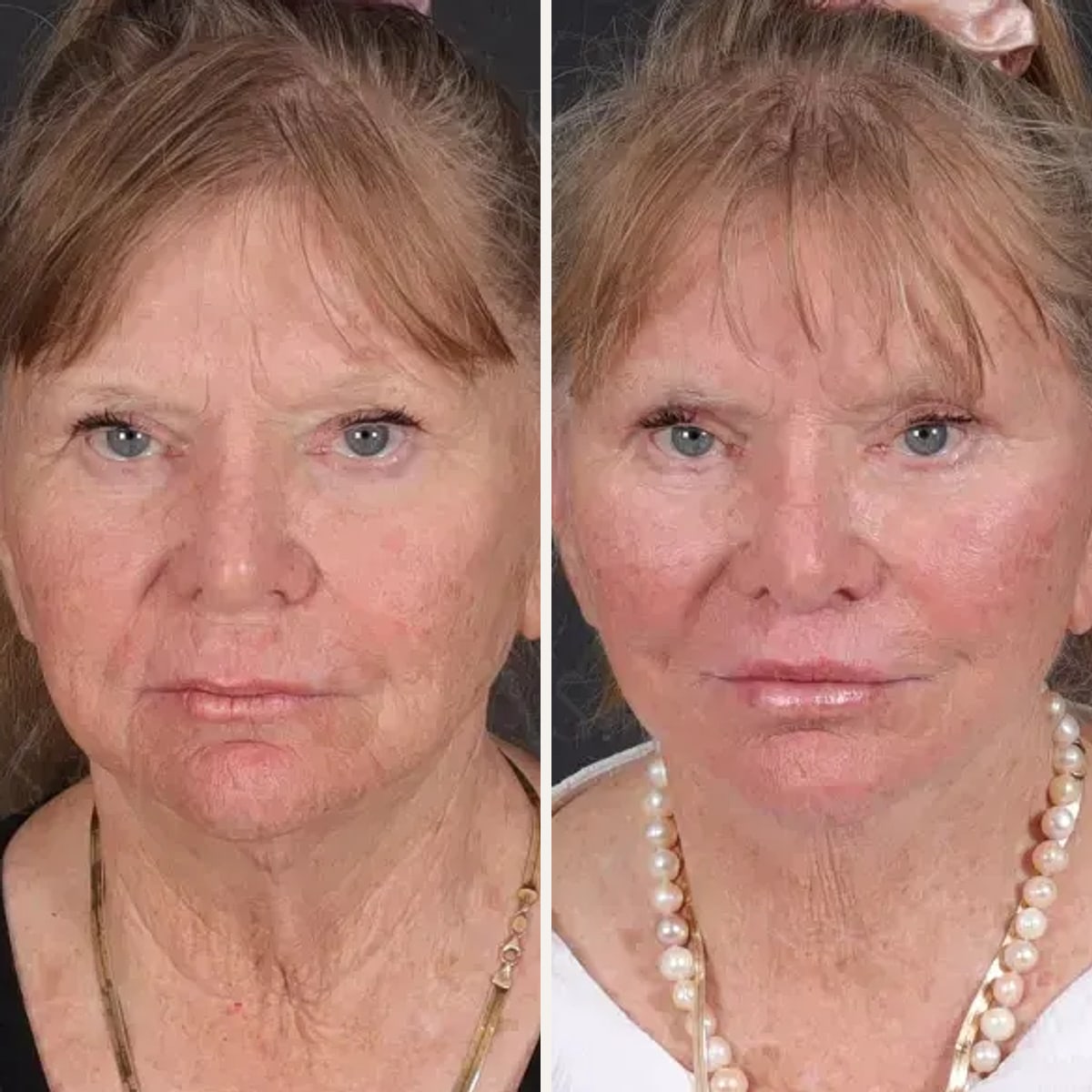 Before and after: Dr. Yasin Varsak