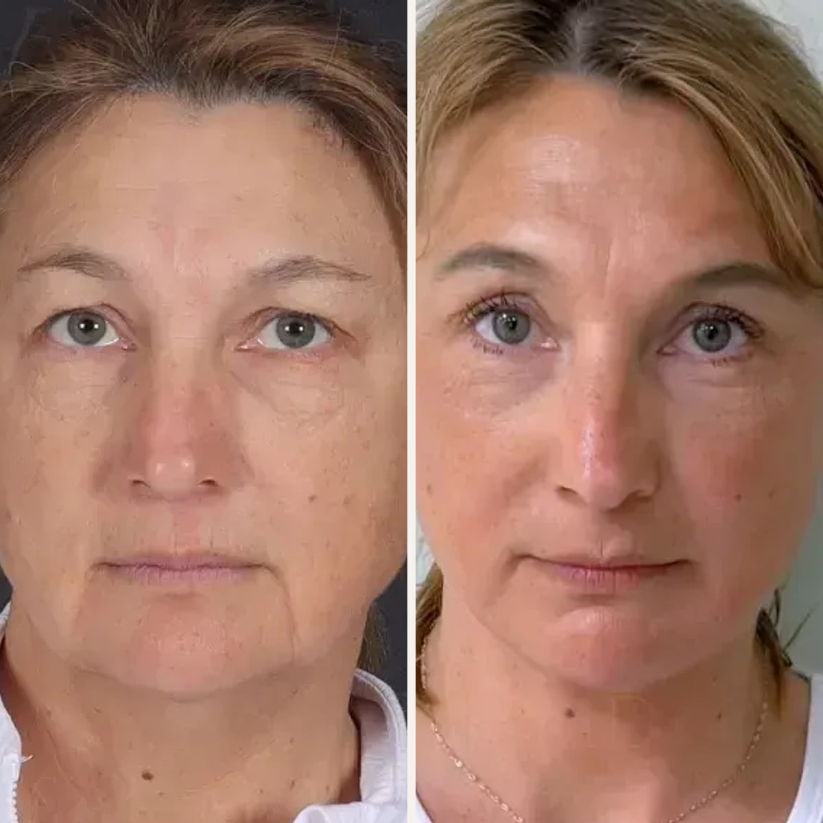 Before and after: Dr. Yasin Varsak