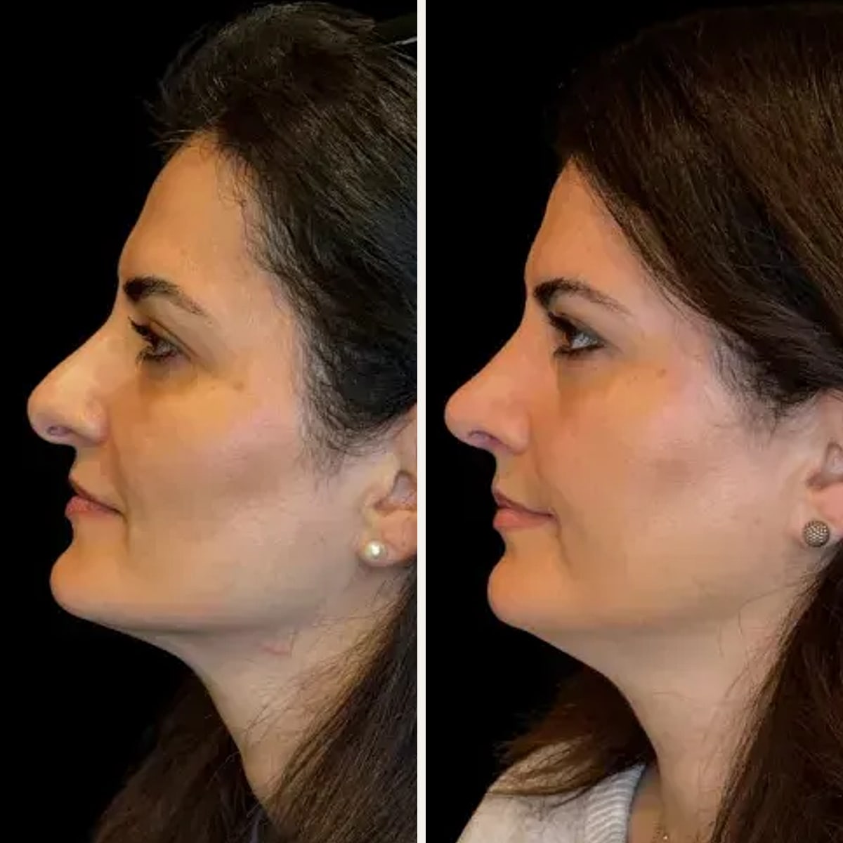 Before and after: Dr. Zeshaan Maan