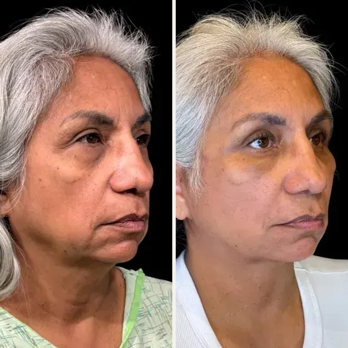 Before and after: Dr. Zeshaan Maan