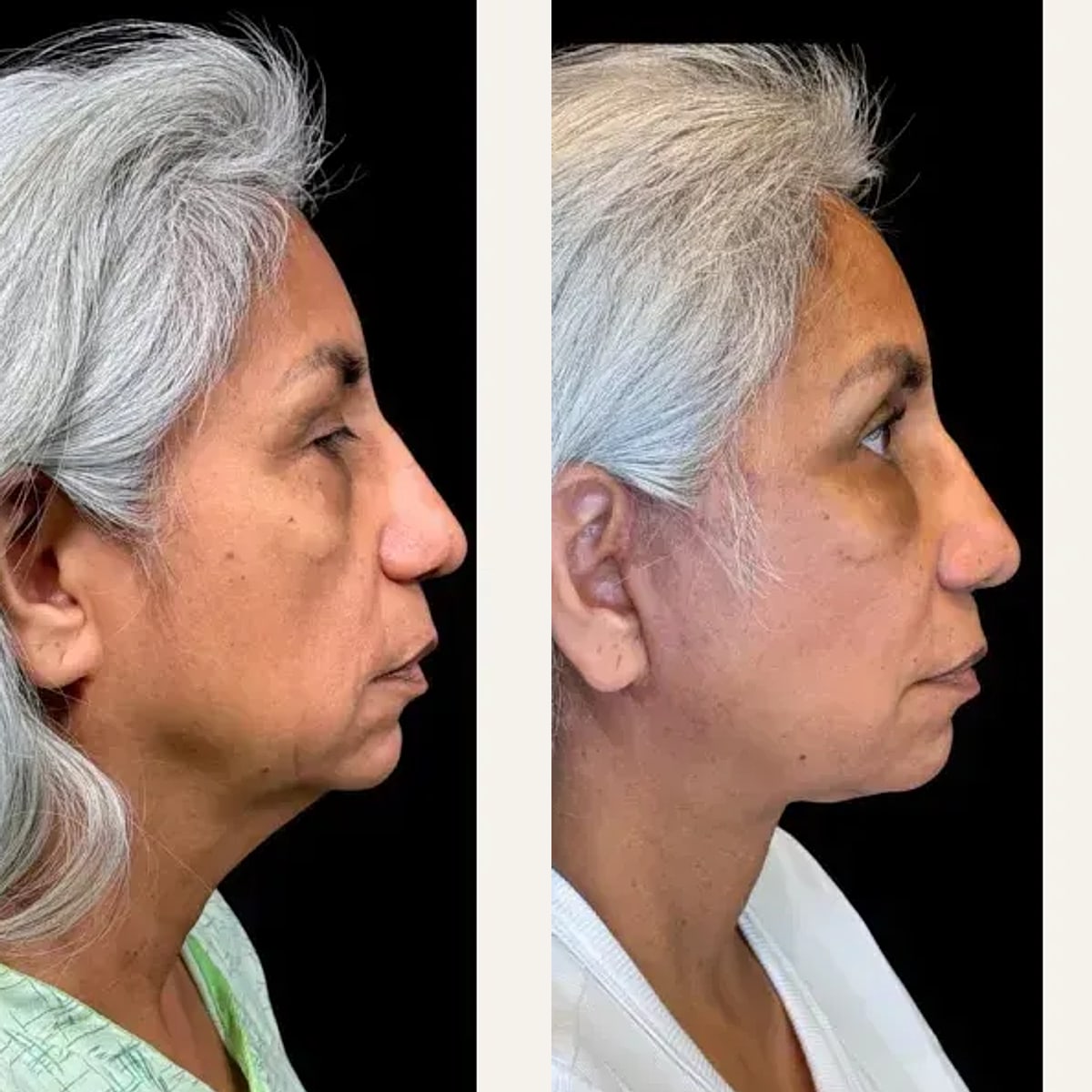 Before and after: Dr. Zeshaan Maan