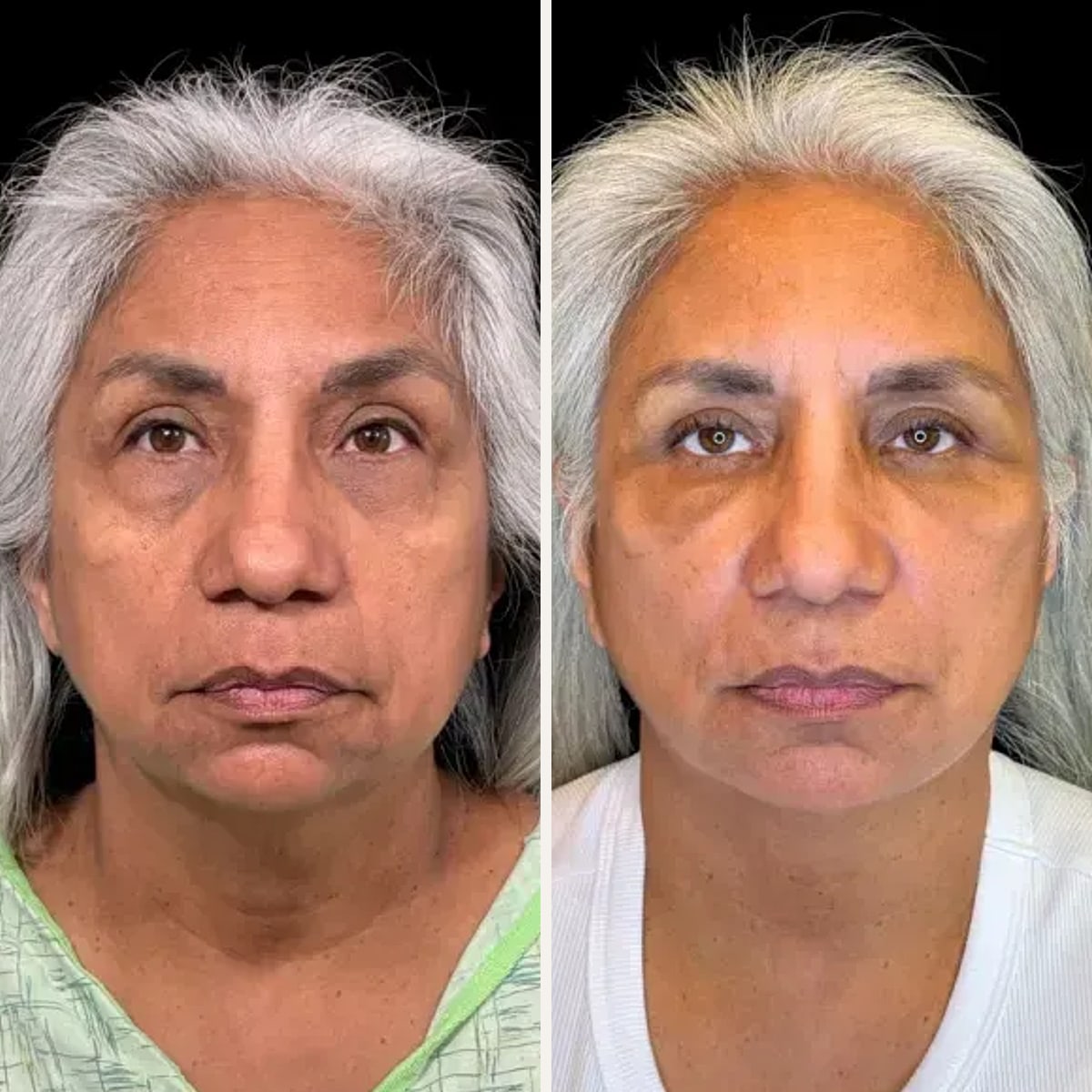 Before and after: Dr. Zeshaan Maan