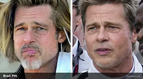 Brad Pitt facelift analysis