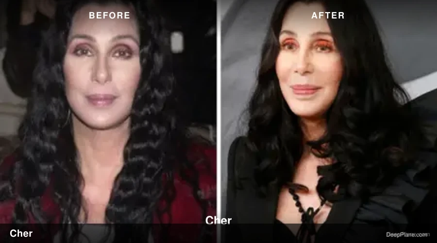 Cher before and after comparison