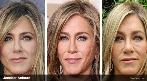 Jennifer Aniston deep plane facelift before and after comparison