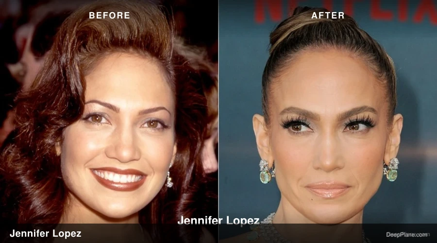 Jennifer Lopez before and after