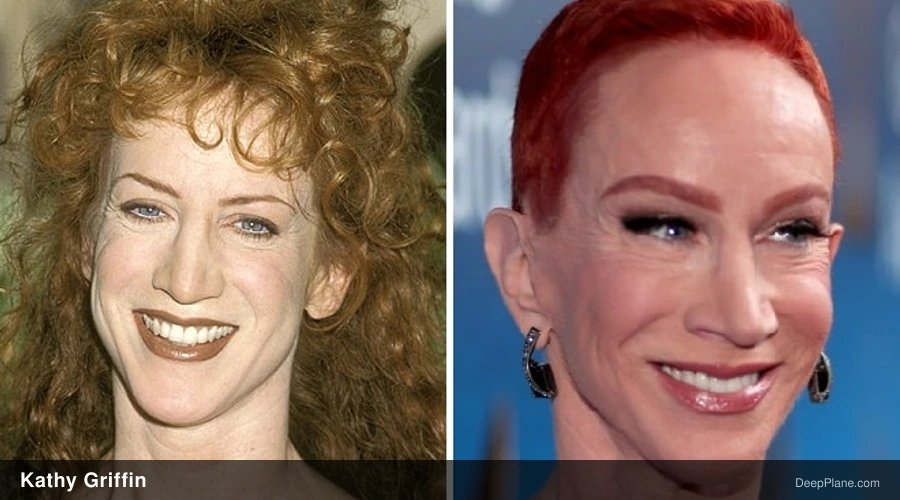 Kathy Griffin before and after comparison