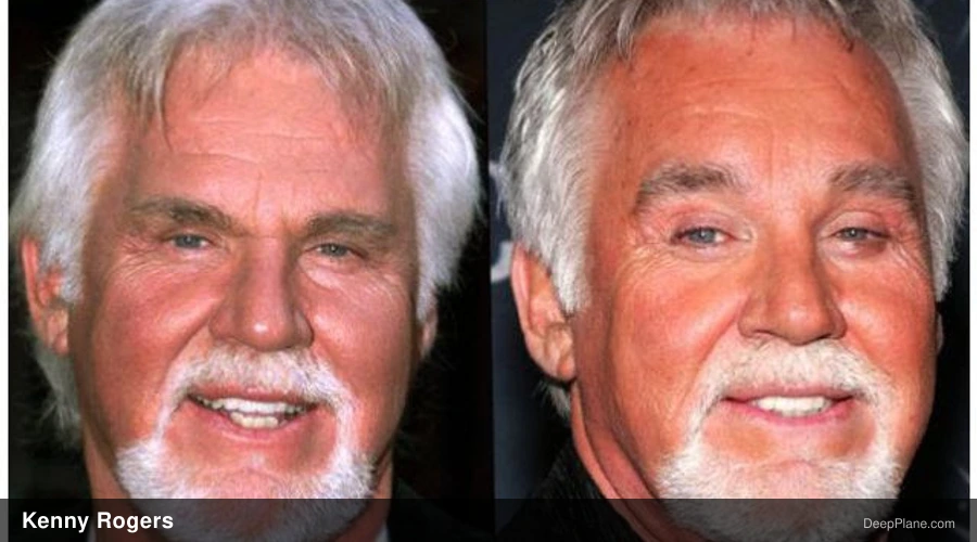 Kenny Rogers before and after comparison