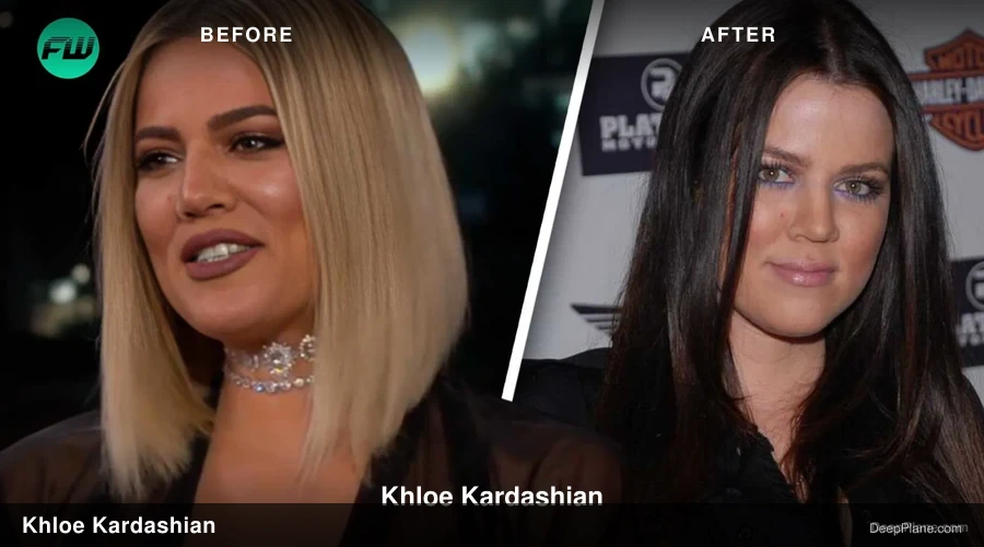 Khloé Kardashian before and after comparison