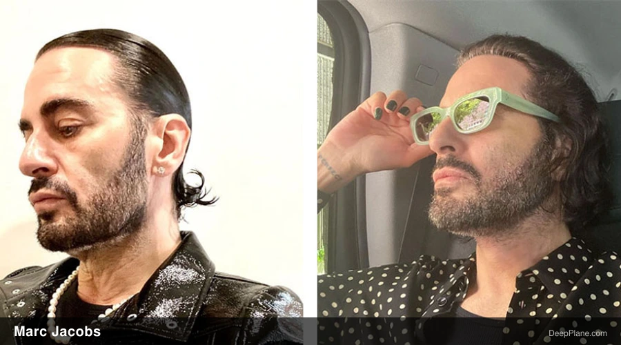 Marc Jacobs before and after