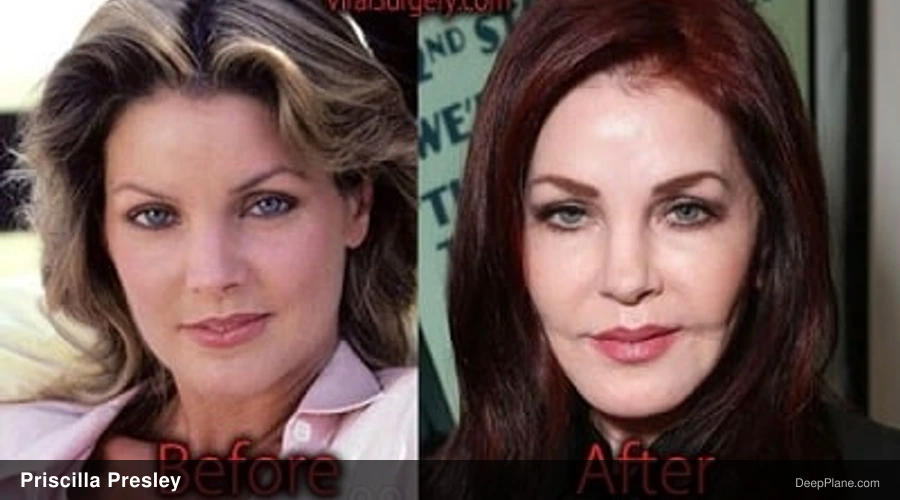 Priscilla Presley before and after comparison