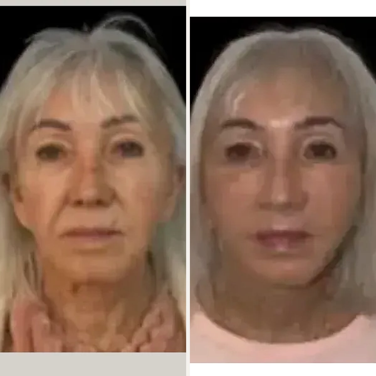 Before and after: Prof. Dr. Ioannis Liapakis