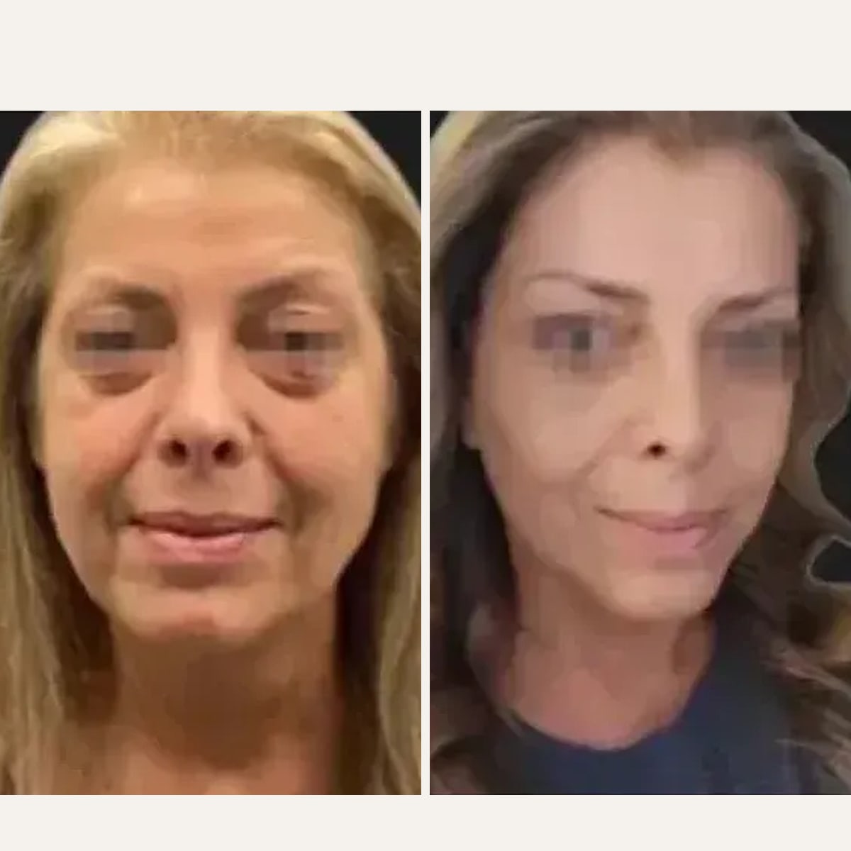Before and after: Prof. Dr. Ioannis Liapakis