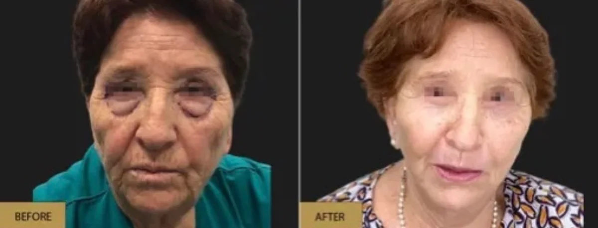 Before and after — Prof. Dr. Ioannis Liapakis