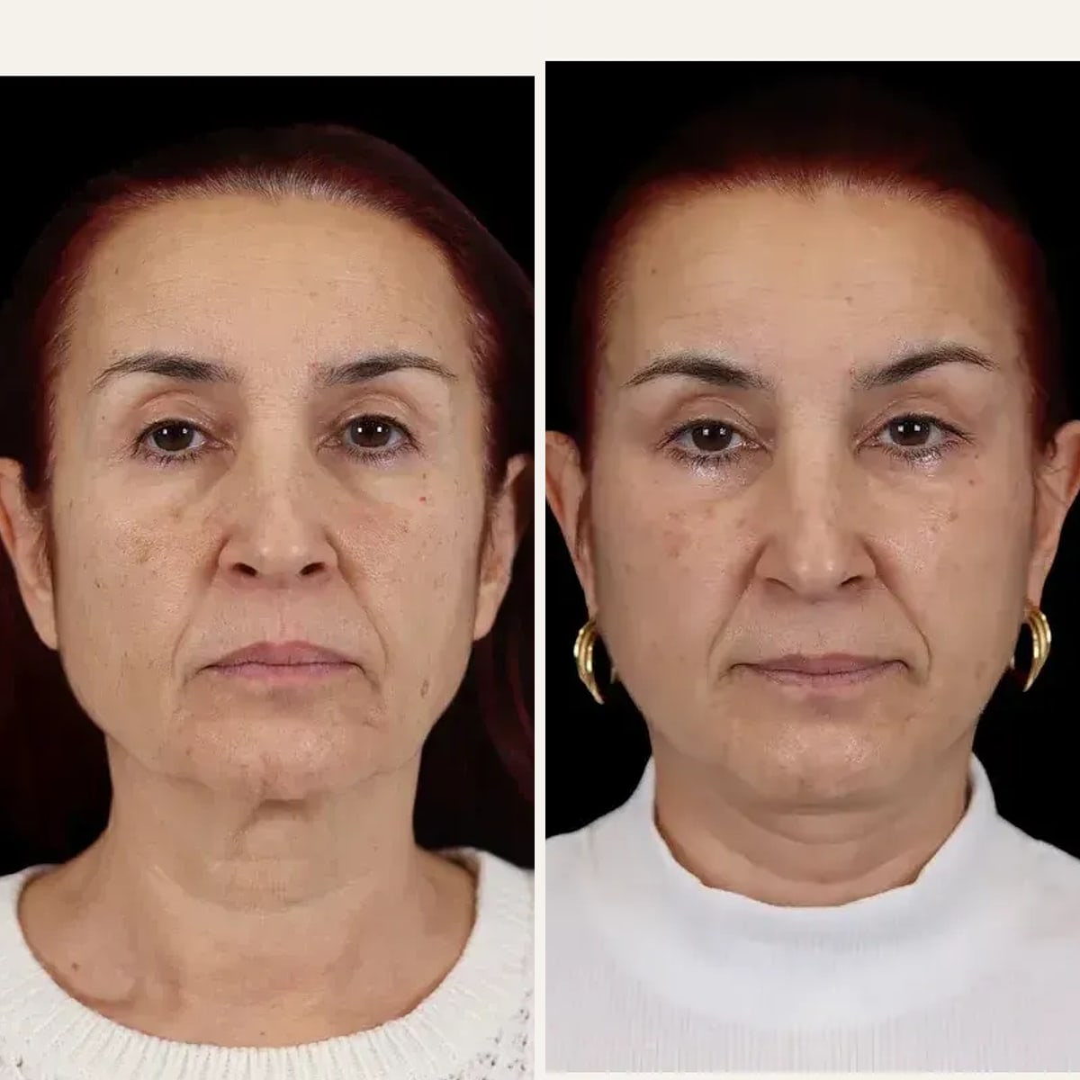 Before and after: Dr. Enio Ilinoiu
