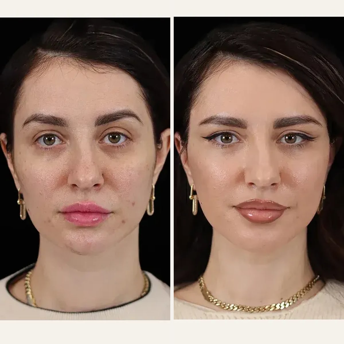 Before and after: Dr. Enio Ilinoiu