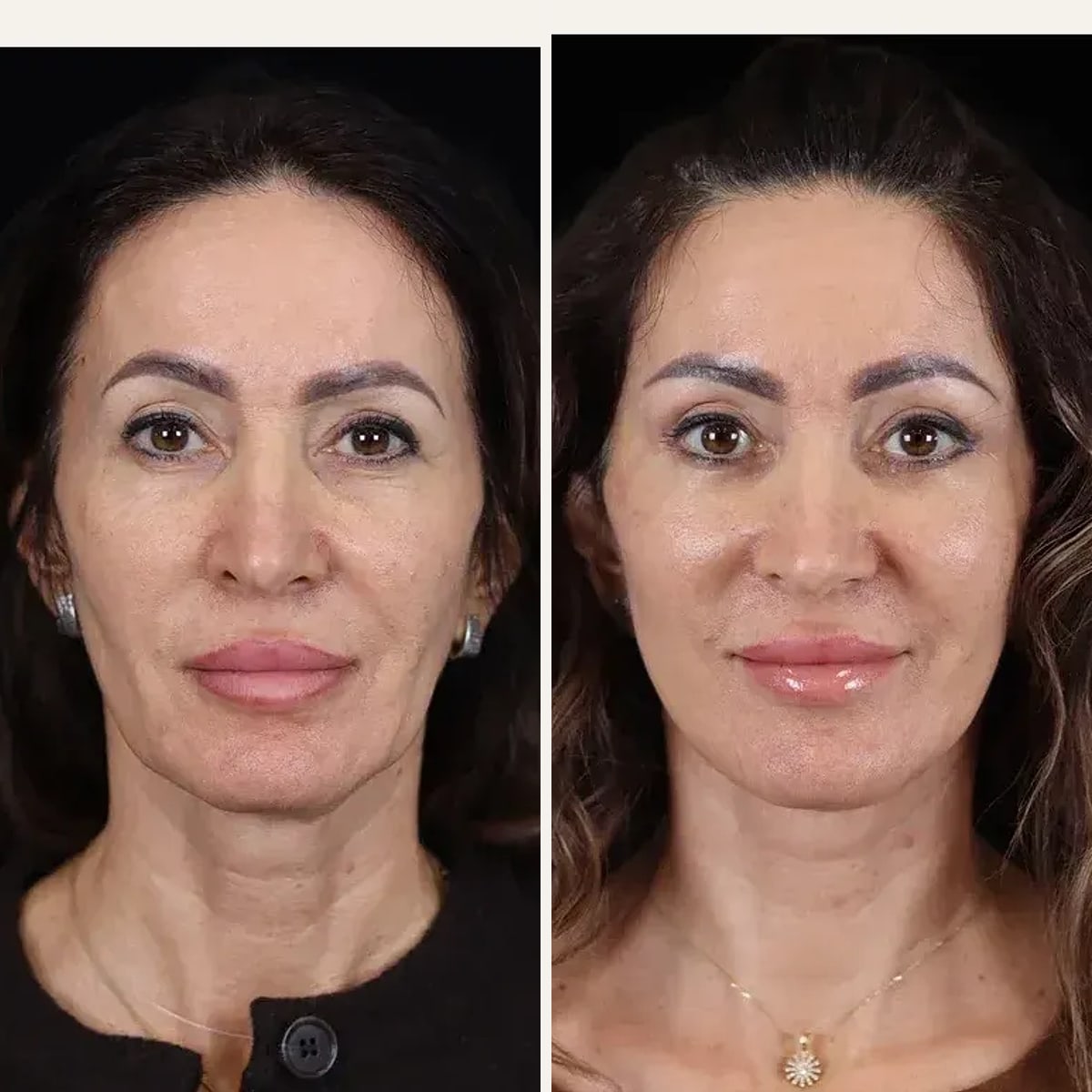 Before and after: Dr. Enio Ilinoiu