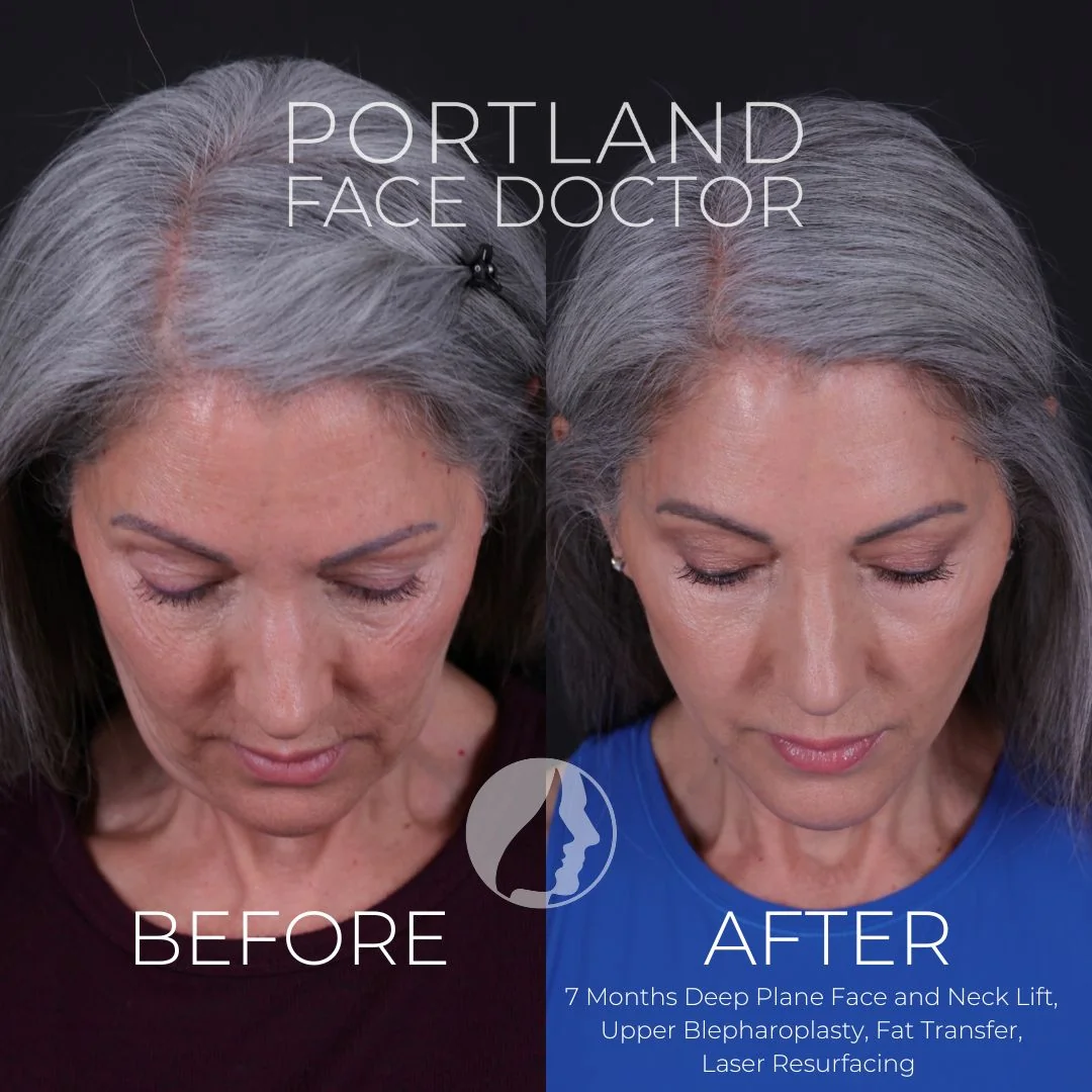 Before and after — Dr. Peter Vila