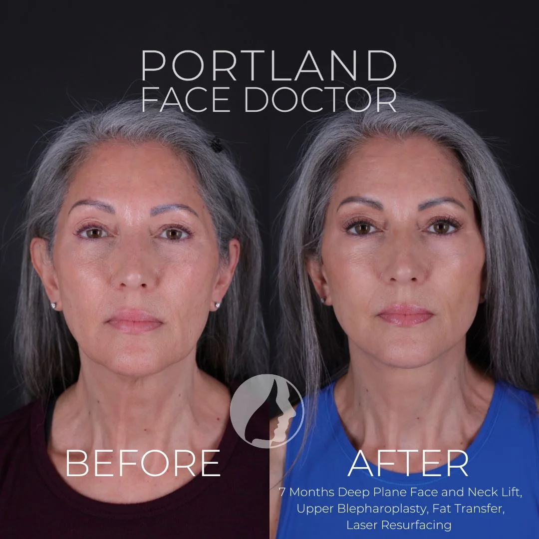 Before and after — Dr. Peter Vila