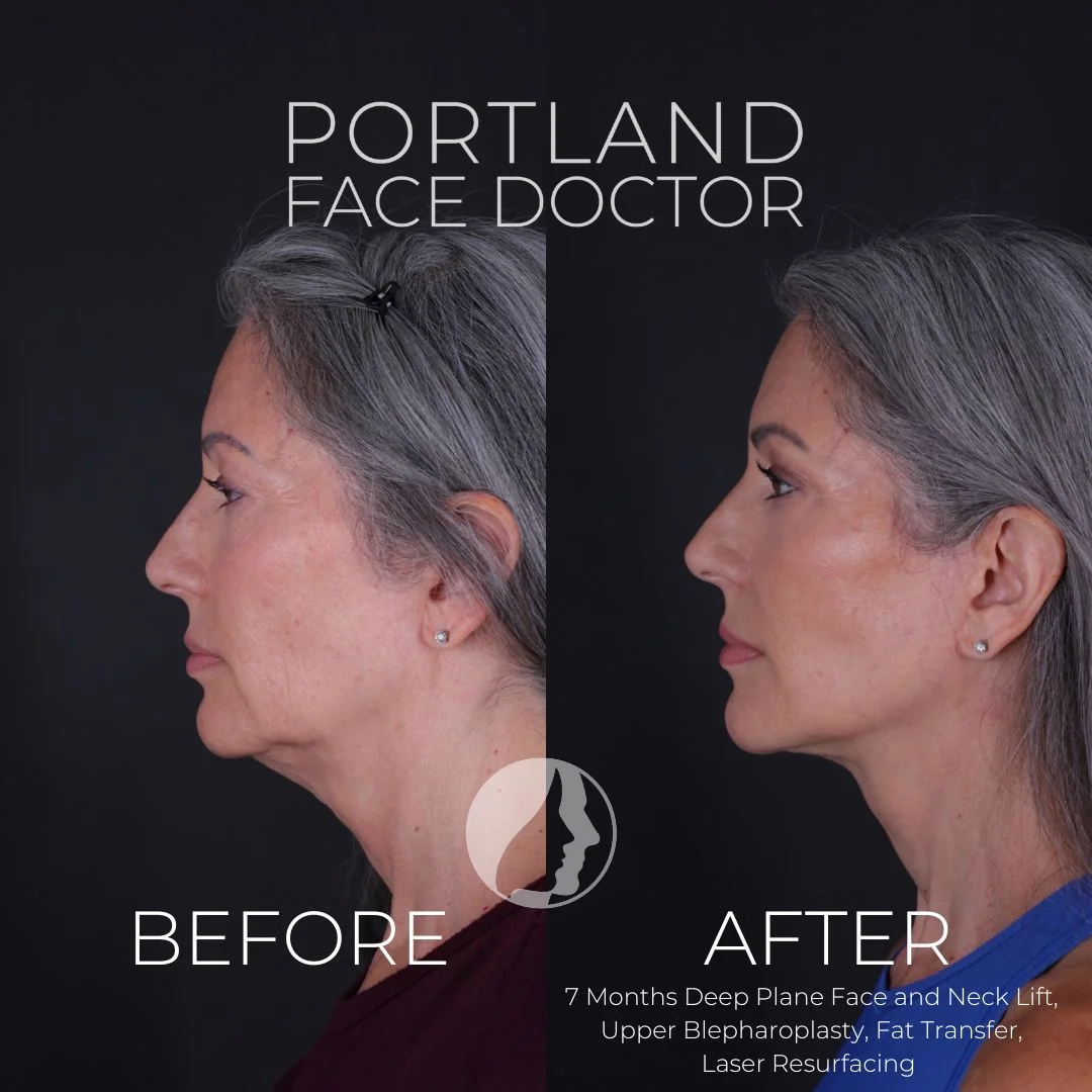 Before and after — Dr. Peter Vila