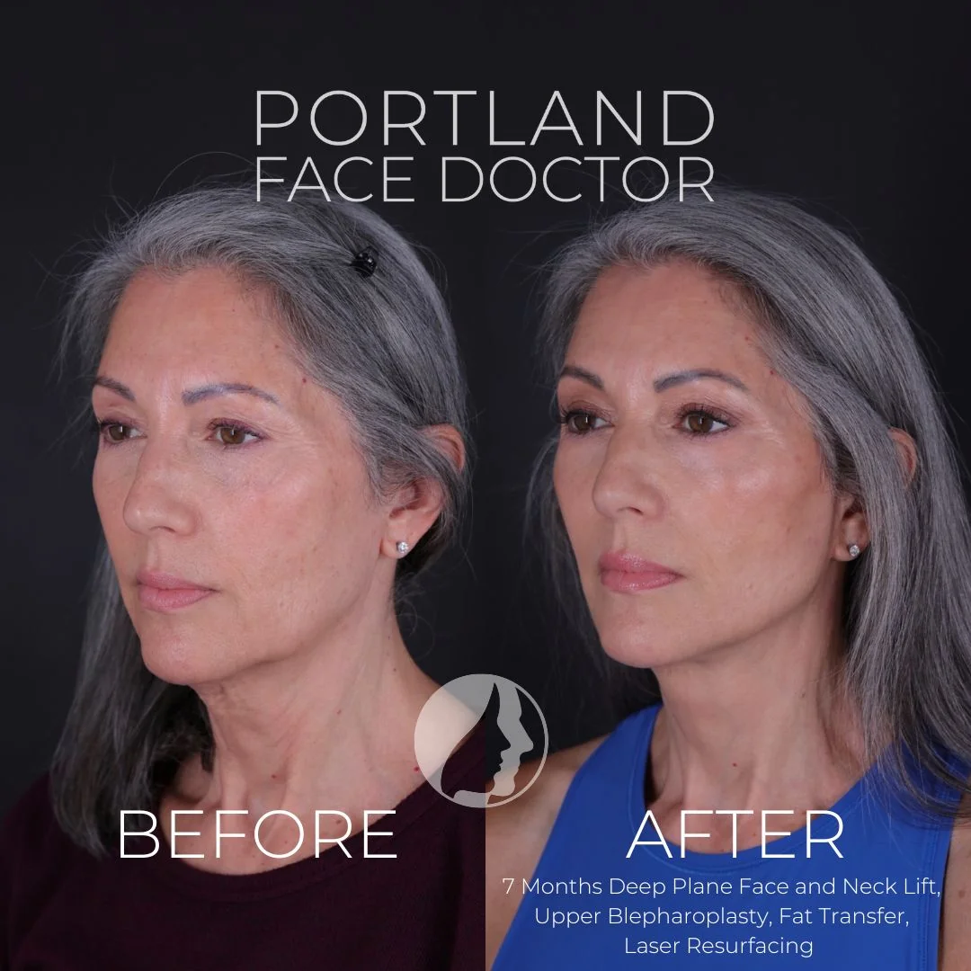Before and after — Dr. Peter Vila